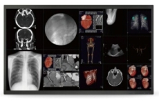 放射科 手术室 教学影像 42寸大屏显示器